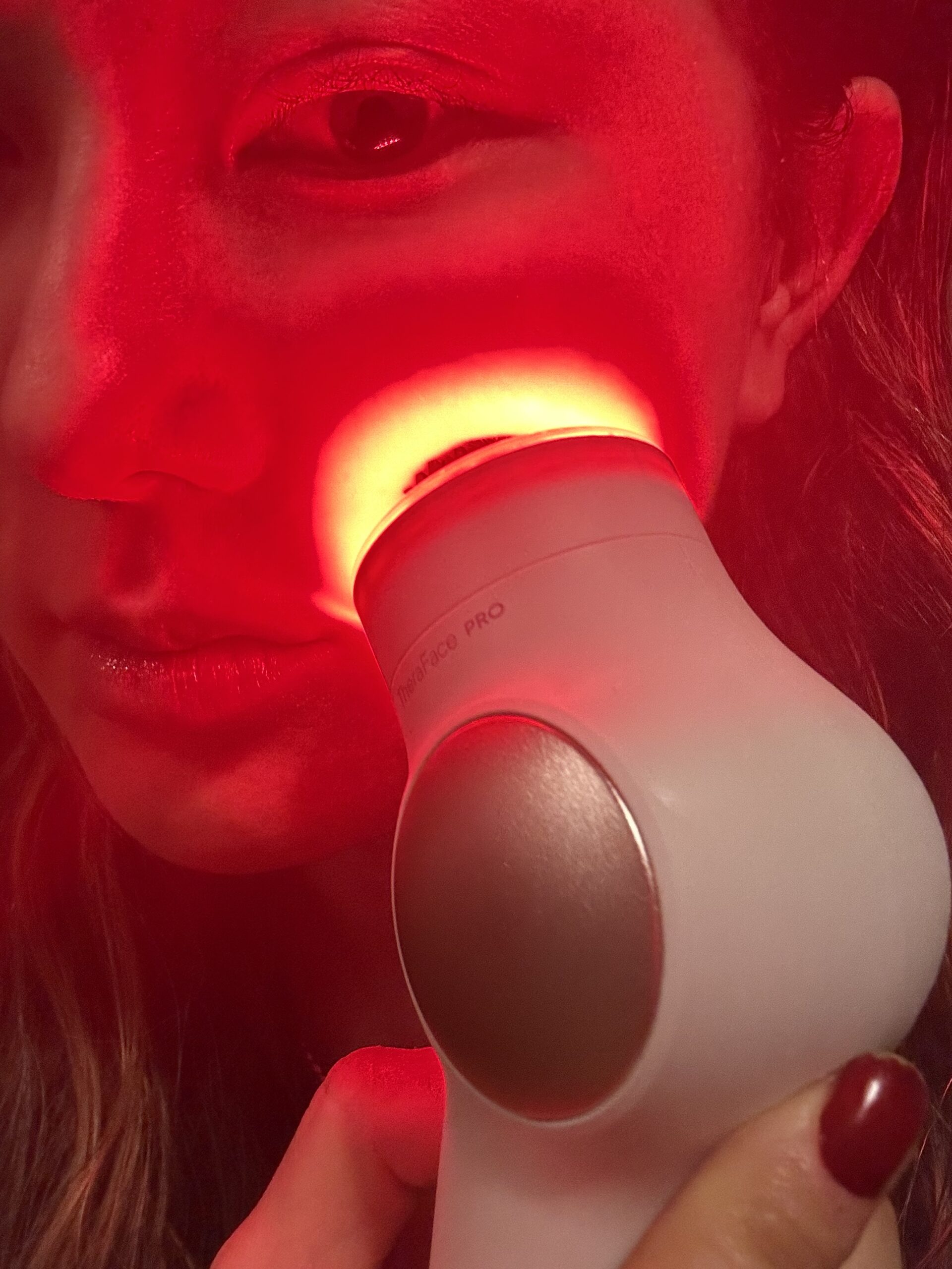 TheraFace led light therapy