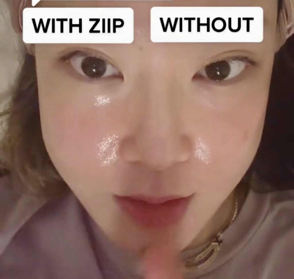 ziip beauty before after